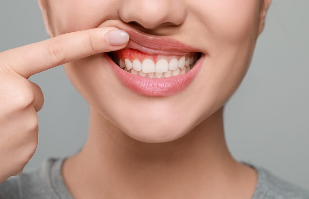 Woman showing inflamed gum on grey background, closeup